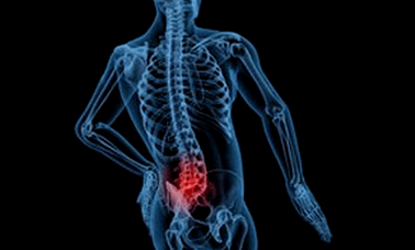 Dôvody rozvoja bedrovej osteochondrózy