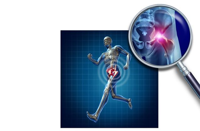 Bolesť pri behu v bedrovom kĺbe